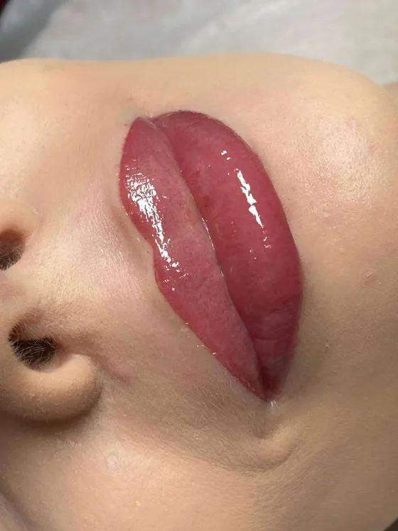Modelowanie ust kwasem hialuronowym Piła — Beauty Station, Dominika